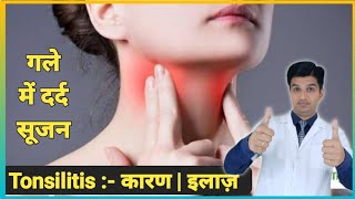 गले में दर्द सूजन का कारण और इलाज  Tonsillitis treatment  Tonsillitis in hindi [upl. by Levitan]