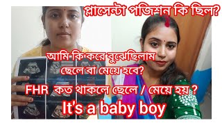 FHR কত থাকলে ছেলেমেয়ে হয়কি কি symptoms দেখে বুঝেছিলাম ছেলে হবেpregnency viralnew born baby [upl. by Lyj103]