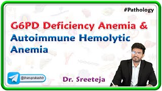 8 G6PD Deficiency Anemia amp Autoimmune Hemolytic Anemia  USMLE Step 1 [upl. by Towny]