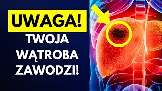 10 objawów że Twoja wątroba przestaje działać [upl. by Flyn974]