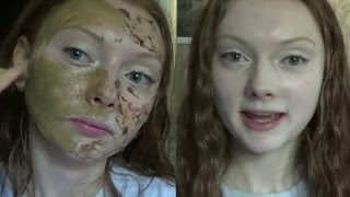 DIY face mask for redness [upl. by Rozalin]