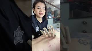 Huong Spa Da Nang shortsrelaxvideoAcne Part 1 [upl. by Omik158]