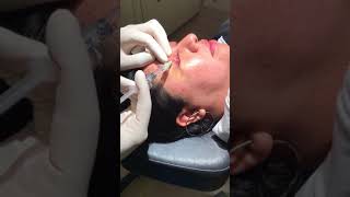 Part I Video of Chalazion and Scar Tissue Removal [upl. by Rasia]