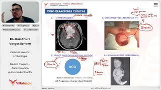 Desarrollo embrionario  Consideraciones clínicas [upl. by Nnylyak]