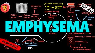 EMPHYSEMA Pathogenesis [upl. by Grinnell]