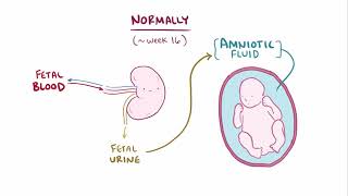 Renal agenesis [upl. by Arihsaj208]