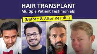 Hair Transplant  Patient Reviews  Medlinks  Before amp After Results  Multiple Client Testimonials [upl. by Etteiluj]