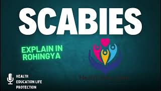 Scabies explain in Rohingya language  Health Education Life protection [upl. by Gasparo]