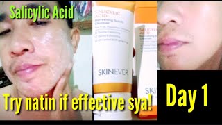 Day 1 Salicylic Acid effective ba [upl. by Ruy44]