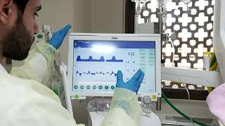 Workshop 9 criteria of extubation spontaneous breathing trial before extubation [upl. by Edmanda138]