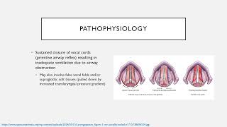 Common Perioperative Complications Keyword Review  Dr Green [upl. by Faus929]