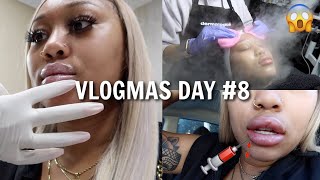 Come With Me to Get Lip Fillers  Vlogmas Day 8 [upl. by Thrasher]