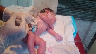 New born male baby with labour breathing baby start gasping take action thank u God baby cry 💞 [upl. by Aicaca]