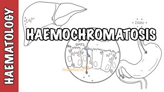 Haemochromatosis Iron Overload  iron physiology causes and pathophysiology [upl. by Imotas836]