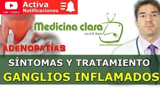 Ganglios inflamados Bultos en cuello axilas ingles ¿cuándo estar alerta  Medicina Clara [upl. by Edmund]