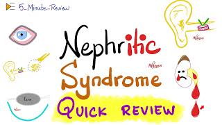 Nephritic Syndrome  APSGN RPGN IgAN Alport  Quick Review  5 Minute Review Series [upl. by Ottilie]