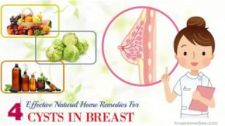 10 Incredibly Effective Home Remedies For Cysts In Breast [upl. by Nwahsram]