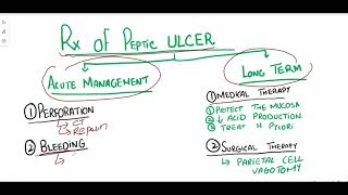 PEPTIC ULCER DISEASEGastric Ulcer vs Duodenal ulcer [upl. by Alihet520]