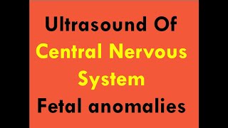 Ultrasound of CNS foetal anomalies [upl. by Epoh]