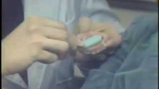 Overdenture Hygiene Procedures [upl. by Leiruh]