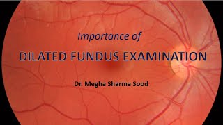 Importance of Dilated Fundus Examination  Dr Megha Sharma Sood [upl. by Lottie]