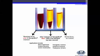 Biotech Support Group HemogloBind™ Hemoglobin Depletion From Hemolyzed SerumPlasma [upl. by Tsugua]