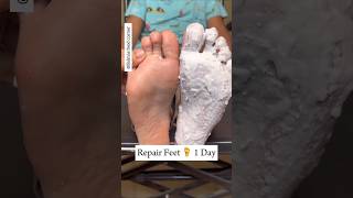 Repair cracked heels in just 1 Day😱softfeet shorts skincare shortsfeed glassskin fairness diy [upl. by Lledyr840]