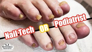 Nail Technician or Podiatrist A Comparison in Feet and Foot Care Approaches [upl. by Ynamreg]