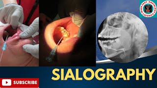 Sialography  Indications amp Contraindications  Contrast media  Procedure amp Technique in Hindi [upl. by Ydospahr]