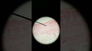 Meissners and Pacinian corpuscle histology [upl. by Boru]