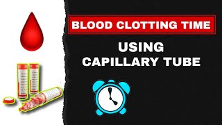 Blood clotting time using capillary tube method  blood clotting time [upl. by Drusilla812]