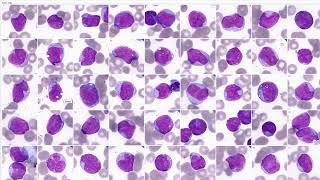 Vision Hema  Automatic Blood Smear Analysis [upl. by Yren239]