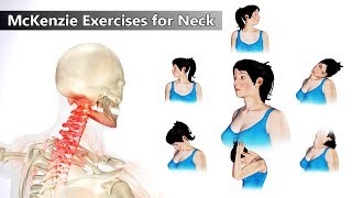 6 Mckenzie Exercises for Neck Pain Relief [upl. by Susy916]