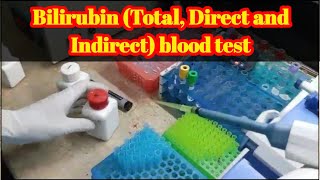 practical vadio on how to perform bilirubin Total Direct and indirect test UrduHindi [upl. by Anigger]