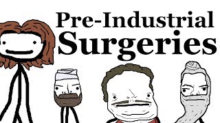 PreIndustrial Surgeries [upl. by Enelra]