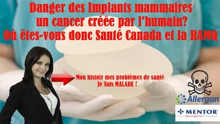 Implants mammaires Danger  je suis malade [upl. by Neve58]