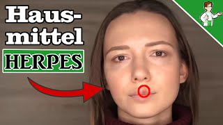 Hausmittel gegen Herpes  Die Top 7 Tipps 👄 [upl. by Dougie863]