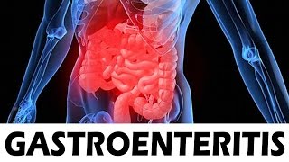 Gastroenteritis – Remedio casero para la gastroenteritis [upl. by Adnirual252]