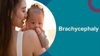 Brachycephaly Positioning for your baby [upl. by Anelis]