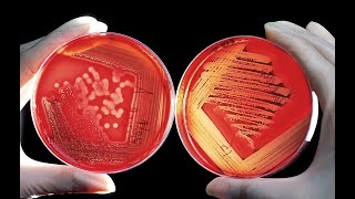 🦠Po jakim czasie probiotyk który ma 2 mld bakterii w kapsułce odbuduje florę jelitową❓ Obliczyłem❗ [upl. by Aehr]