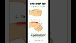 Finkelstein test viralshort allaboutnorcet medicaleducation biology nursingofficer [upl. by Nolyd183]