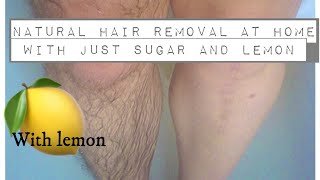 Natural Hair Removal At Home With Just Sugar And Lemon  With Full Demostration [upl. by Baruch]