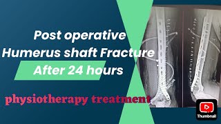 POST OPERATIVE HUMERUS FRACTURE AFTER 24HR  PHYSIOTHERAPY TREATMENT EXERCISE [upl. by Brote]