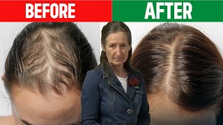 STOP Hair Loss NOW Barbara ONeills SHOCKING Hair Growth Secrets [upl. by Mauralia]