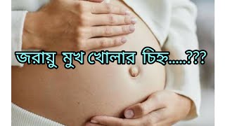 জরায়ু মুখ খোলার চিহ্ন। cirvix opening signSumonayesmingl5qv [upl. by Janean641]