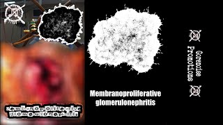 MxTxA  Membranoproliferative glomerulonephritis Full Album Gorenoise [upl. by Leunas578]