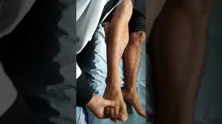 Ankle clonus demonstration [upl. by Thacher152]