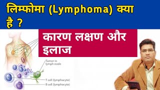 What is Lymphoma  its Cause Symptoms and Treatment [upl. by Enelam]