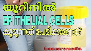 Urine test malayalam epithelial cells in urineurinetest urineinfection urine [upl. by Dunlavy]