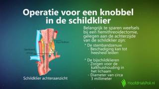 Knobbel in de schildklier [upl. by Ailat]